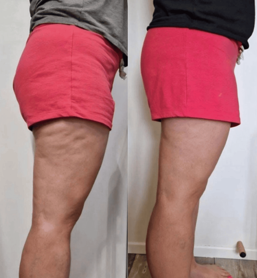 Mariana before and after