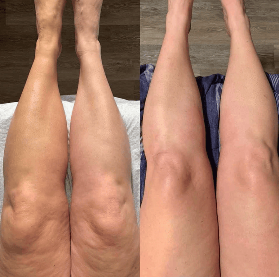 Athena before and after