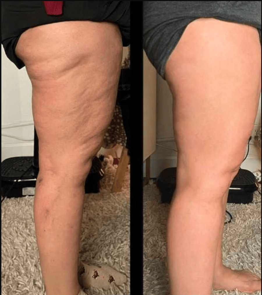 Samyrna before and after